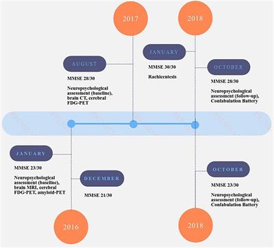 Confabulations in Cases of Dementia: Atypical Early Sign of Alzheimer’s Disease or Misleading Feature in Dementia Diagnosis?